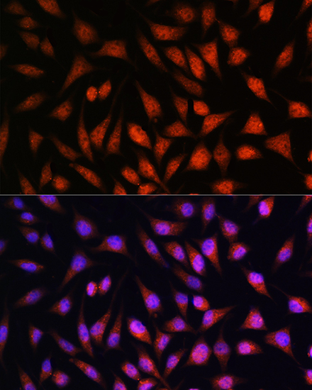 Anti-STAT1 Antibody (CAB12075)