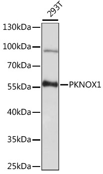 Anti-PKNOX1 Antibody (CAB15301)