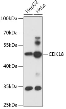 Anti-CDK18 Antibody (CAB17515)