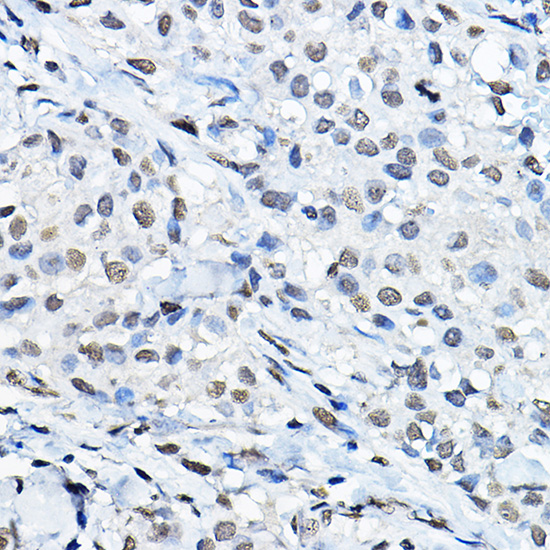 Anti-MonoMethyl-Histone H3-K27 Antibody (CAB2361)