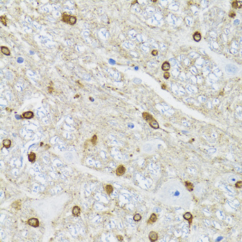 Anti-TPPP Polyclonal Antibody (CAB8574)