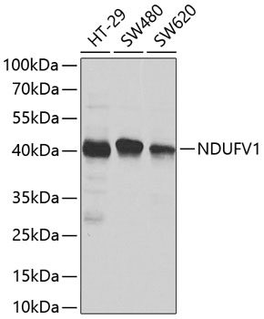 Anti-NDUFV1 Polyclonal Antibody (CAB8014)