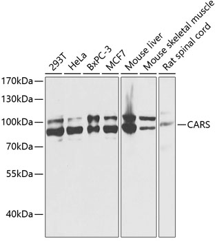 Anti-CARS Antibody (CAB13676)