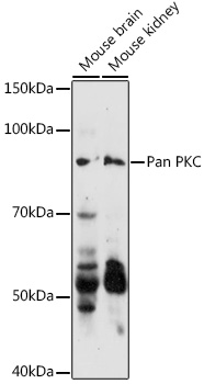 Anti-Pan PKC Antibody (CAB17921)