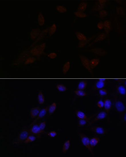 Anti-ATF4 Antibody (CAB0201)