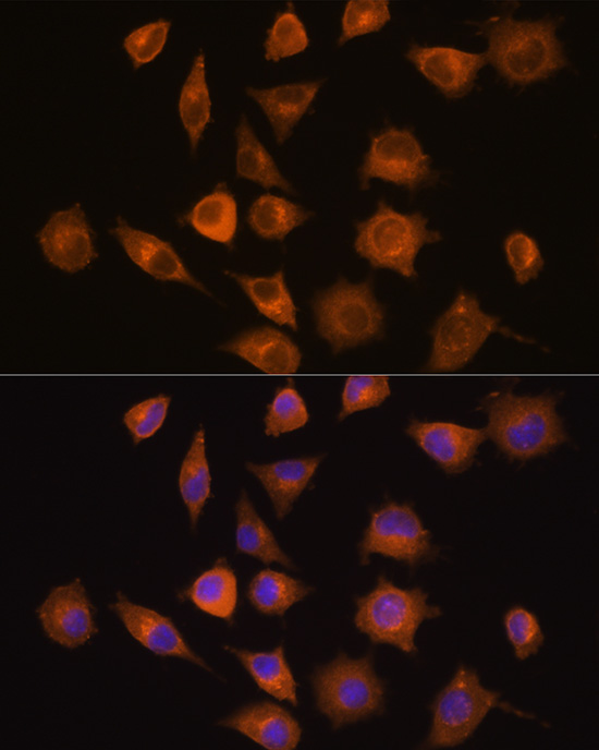 Anti-EIF2AK3 Antibody (CAB18196)