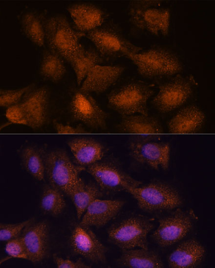 Anti-UPF3A Antibody (CAB15893)