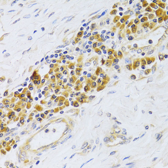 Anti-PA2G4 Antibody (CAB5376)