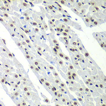 Anti-SF3B2 Antibody (CAB5875)