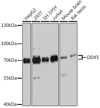 Anti-DDX5 Antibody (CAB13294)