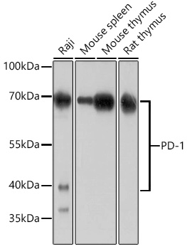 Anti-PD-1 Antibody (CAB11973)