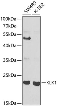 Anti-KLK1 Antibody (CAB1807)