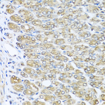 Anti-RAC2 Antibody (CAB1139)