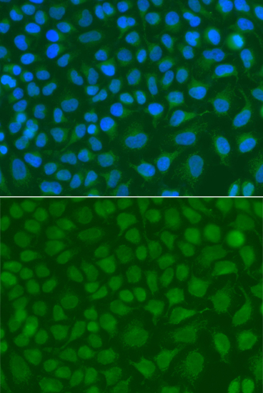 Anti-SSX5 Antibody (CAB7732)