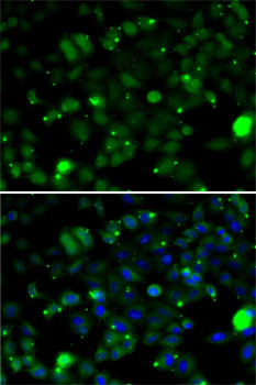 Anti-TAGLN2 Antibody [KO Validated] (CAB6761)