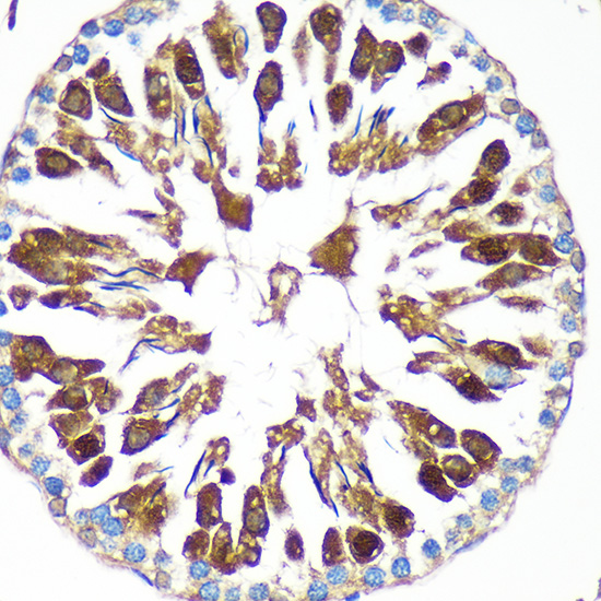 Anti-CAND2 Antibody (CAB16500)