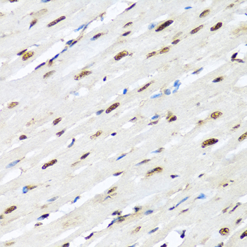 Anti-HNRNPR Antibody (CAB5883)