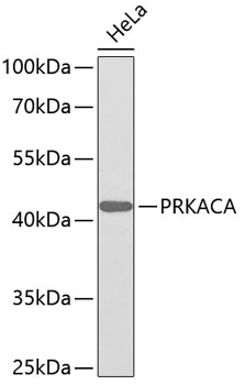 Anti-PRKACA Antibody (CAB0798)