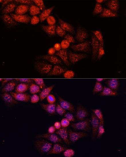 Anti-GSK3Beta Antibody [KO Validated] (CAB6164)