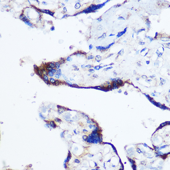 Anti-DICER1 Antibody (CAB6021)