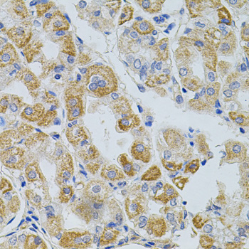 Anti-PCSK9 Antibody (CAB7860)