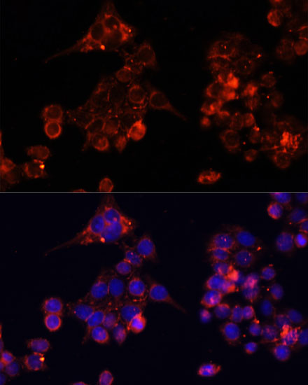 Anti-B4GALT4 Antibody (CAB14693)