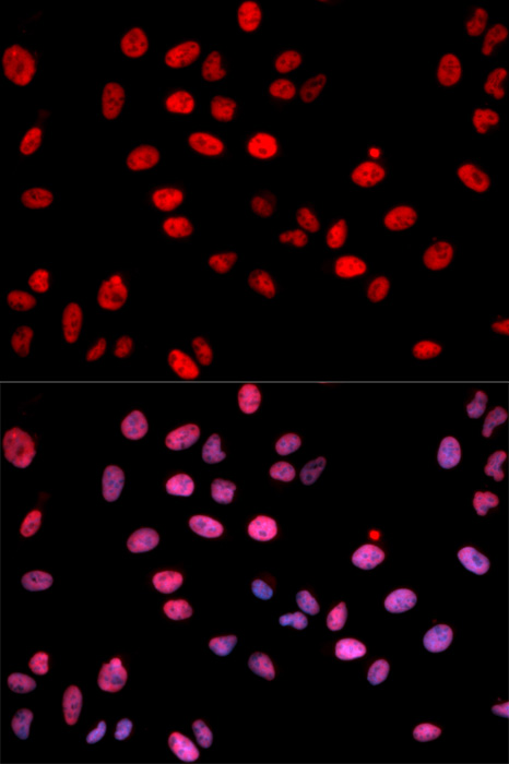 Anti-Phospho-Jun-S243 Antibody (CABP0050)