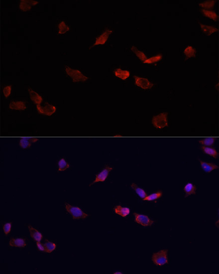 Anti-BMPR2 Antibody (CAB5666)