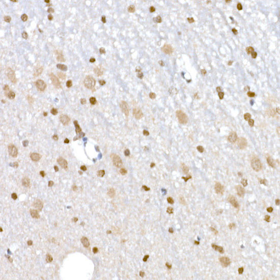 Immunohistochemistry of paraffin-embedded rat spleen using PLK1 Rabbit mAb at dilution of 1:100 (40x lens). Perform high pressure antigen retrieval with 10 mM citrate buffer pH 6. 0 before commencing with IHC staining protocol.