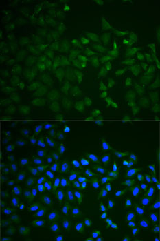 Anti-TNFRSF11B Antibody (CAB2100)