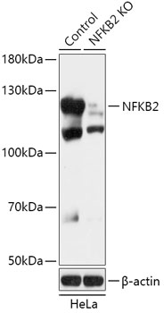 [KO Validated] NF-kB2 Rabbit Polyclonal Antibody (CAB18062)