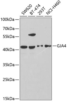 Anti-GJA4 Antibody (CAB2529)