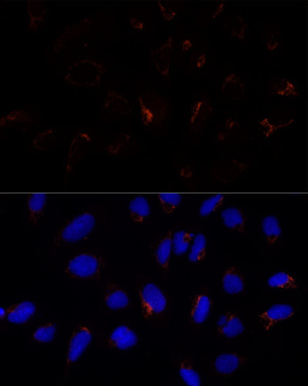 Anti-ETHE1 Antibody (CAB10142)