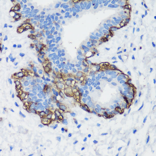 Anti-FLNA Antibody (CAB16376)