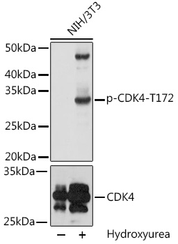 Anti-Phospho-CDK4-T172 Antibody (CABP0593)