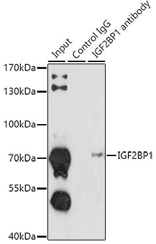 Anti-IGF2BP1 Antibody (CAB13581)