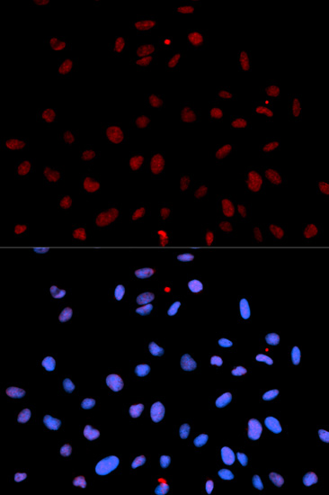 Anti-Phospho-MET-Y1235 Antibody (CABP0079)