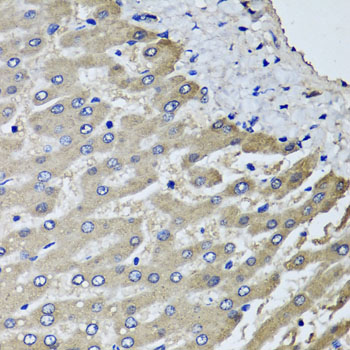 Anti-SCYL1 Antibody (CAB6735)