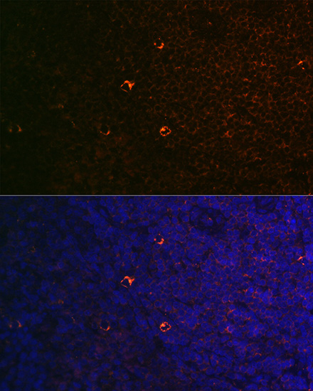 Anti-CD68 Antibody (CAB13286)