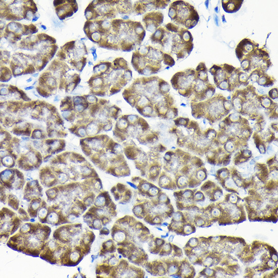 Anti-RPS15A Antibody (CAB10241)