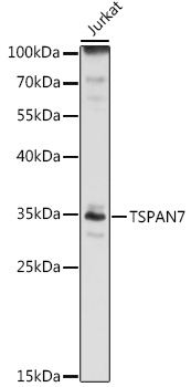 Anti-TSPAN7 Antibody (CAB13555)