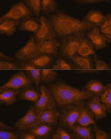 Anti-GIT1 Antibody [KO Validated] (CAB15437)