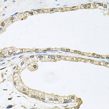 Anti-CDK1 Antibody (CAB2861)