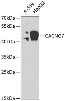 Anti-CACNG7 Polyclonal Antibody (CAB7989)