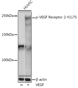 Anti-Phospho-VEGF Receptor 2-Y1175 Antibody (CABP1095)