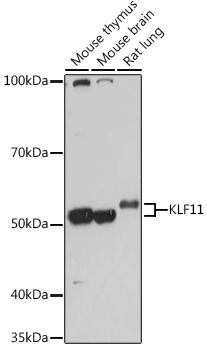 Anti-KLF11 Antibody (CAB18659)