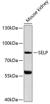 Anti-SELP Antibody (CAB12501)