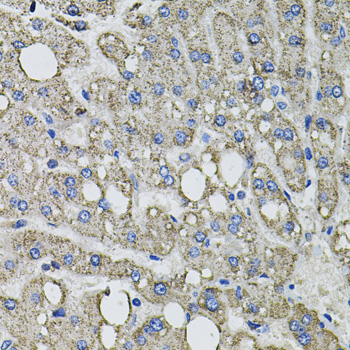 Anti-GFPT1 Antibody (CAB3882)