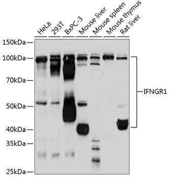 Anti-IFNGR1 Antibody