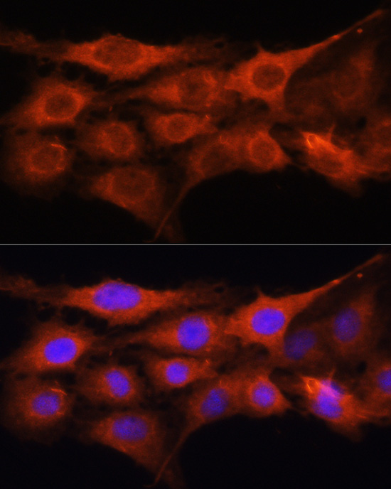 Anti-GALNS Antibody (CAB5461)